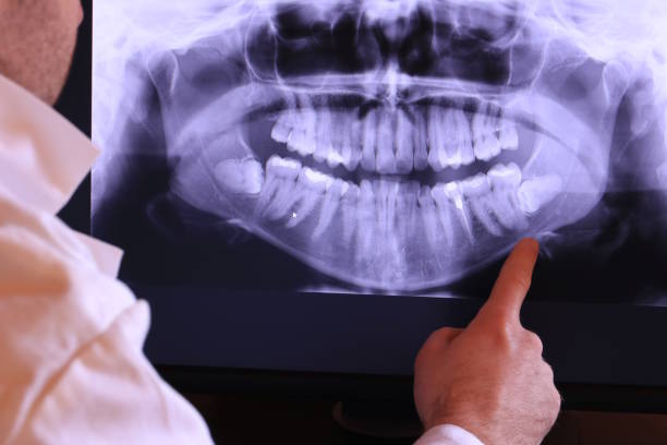 Best Tooth Infection Emergency Dentist  in Pepperdine University, CA
