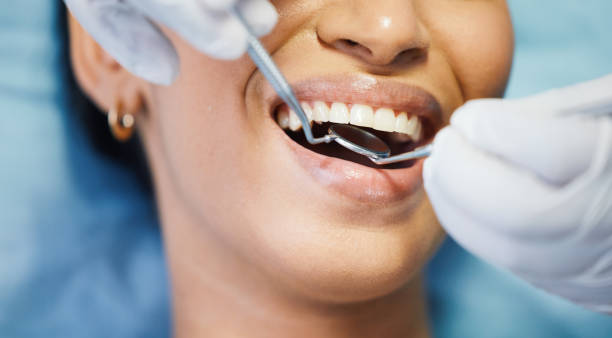 Best Dentist for Dental Trauma  in Pepperdine University, CA
